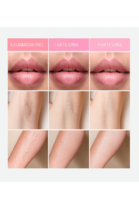 دستگاه لیزر خانگی مدل Bright Elegance BE-9020 IPL Laser Hair Removal