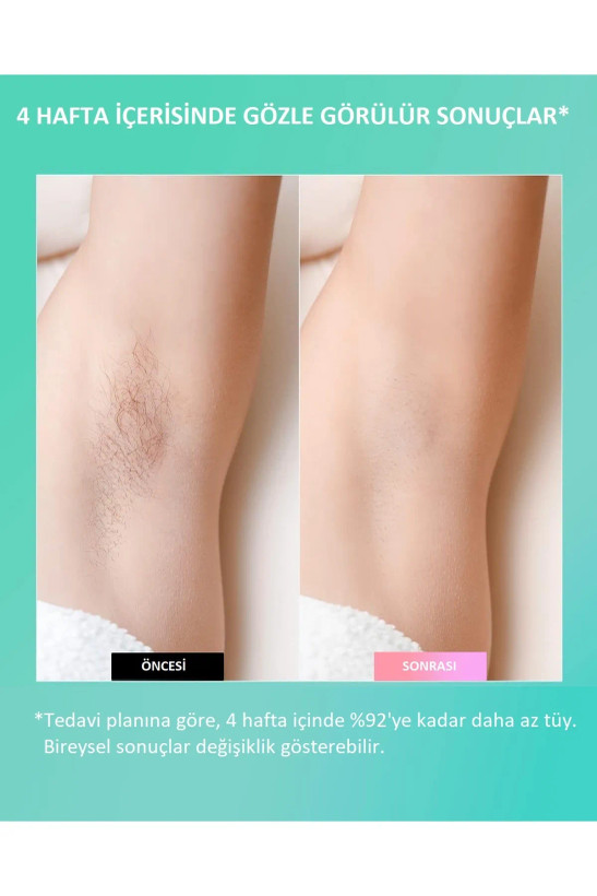 دستگاه لیزر خانگی مدل Bright Elegance BE-9020 IPL Laser Hair Removal